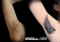 手術の痕（羽でカバー）