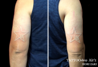 ホワイトTATTOO